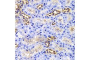 Immunohistochemistry of paraffin-embedded Rat kidney using DIAPH1 antibody at dilution of 1:100 (x40 lens). (DIAPH1 抗体)
