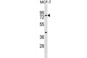 Western Blotting (WB) image for anti-TOX High Mobility Group Box Family Member 4 (TOX4) antibody (ABIN2999628) (TOX4 抗体)