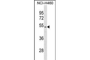 PTEN Antibody (/) (ABIN6242543 and ABIN6577361) western blot analysis in NCI- cell line lysates (35 μg/lane). (PTEN 抗体  (AA 361-390))