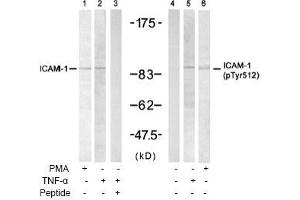 Image no. 1 for anti-Intercellular Adhesion Molecule 1 (ICAM1) (Tyr512) antibody (ABIN197276) (ICAM1 抗体  (Tyr512))