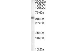 Western Blotting (WB) image for anti-Epithelial Splicing Regulatory Protein 2 (ESRP2) (N-Term) antibody (ABIN2156786) (ESRP2 抗体  (N-Term))