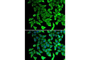 Immunofluorescence analysis of A549 cells using PTGES2 antibody. (PTGES2 抗体)