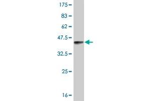 Western Blot detection against Immunogen (35. (RORB 抗体  (AA 136-224))