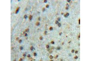 Used in DAB staining on fromalin fixed paraffin-embedded brain tissue (SRPK2 抗体  (AA 380-617))