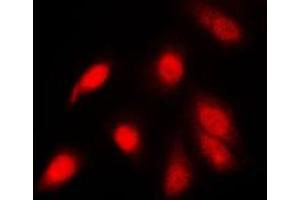 Immunofluorescent analysis of NF-kappaB p65 (pS311) staining in PC12 cells. (NF-kB p65 抗体  (pSer311))