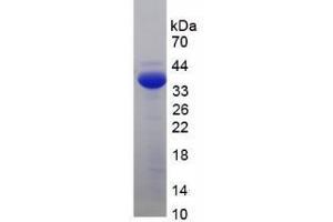 SDS-PAGE analysis of Human Adrenocorticotropic Hormone Protein. (POMC 蛋白)