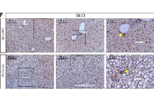 Immunohistochemistry (IHC) image for anti-GLI Family Zinc Finger 3 (GLI3) antibody (ABIN2855813)