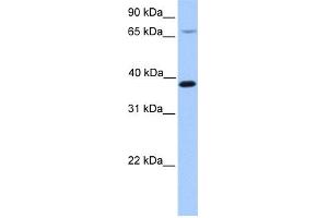 WB Suggested Anti-HMBS Antibody Titration: 0. (HMBS 抗体  (N-Term))