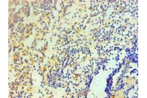 Immunohistochemical of paraffin-embedded Human spleen tissue using ABIN7156047 at dilution of 1:200. (IL1A 抗体)