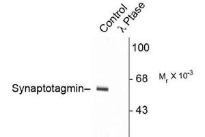 Image no. 2 for anti-Synaptotagmin I (SYT1) (pThr202) antibody (ABIN228043) (SYT1 抗体  (pThr202))