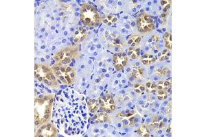 Immunohistochemistry of paraffin-embedded rat kidney using GIP antibody. (GIP 抗体)