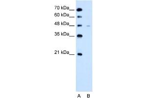 WB Suggested Anti-SLC43A3 Antibody Titration:  2. (SLC43A3 抗体  (N-Term))