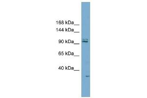 RC3H2 antibody used at 1 ug/ml to detect target protein. (RC3H2 抗体  (Middle Region))