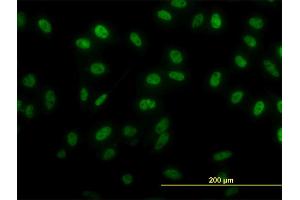 Immunofluorescence of monoclonal antibody to SIX4 on HeLa cell. (SIX4 抗体  (AA 672-780))