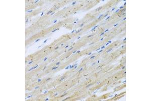 Immunohistochemistry of paraffin-embedded rat heart using CLIP1 antibody (ABIN5975170) at dilution of 1/100 (40x lens). (CLIP1 抗体)