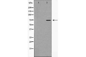 Western blot analysis of hnRNP M expression in HT29 cells,The lane on the left is treated with the antigen-specific peptide. (HNRNPM 抗体  (N-Term))