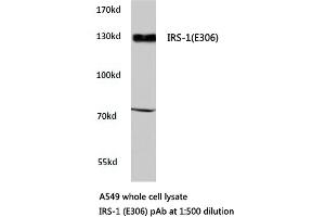 Western blot (WB) analyzes of IRS-1 antibody in extracts from A549 cells. (IRS1 抗体)