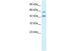 Western Blotting (WB) image for anti-Autophagy related 4B Cysteine Peptidase (ATG4B) antibody (ABIN2460951) (ATG4B 抗体)