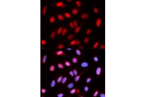 Immunofluorescence (IF) image for anti-Replication Factor C (Activator 1) 4, 37kDa (RFC4) antibody (ABIN1876673) (RFC4 抗体)