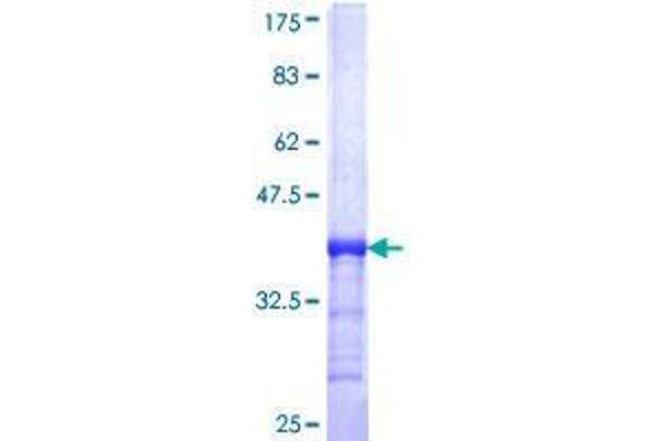 TADA2B Protein (AA 2-110) (GST tag)