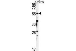 Western blot analysis of FKBP9 antibody (N-term) in mouse kidney tissue lysates (35 µg/lane). (FKBP9 抗体  (N-Term))