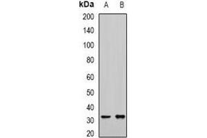 Western blot analysis of RCAS1 expression in mouse kidney (A), mouse liver (B) whole cell lysates. (RCAS1 抗体)