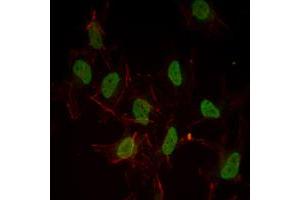 Immunofluorescence analysis of Hela cells using ESR1 mouse mAb (green). (Estrogen Receptor alpha 抗体)