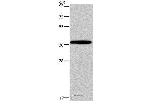 Western blot analysis of Mouse brain tissue, using DLX4 Polyclonal Antibody at dilution of 1:900 (DLX4 抗体)