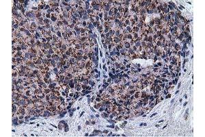 Immunohistochemical staining of paraffin-embedded Human liver tissue using anti-NT5DC1 mouse monoclonal antibody. (NT5DC1 抗体)