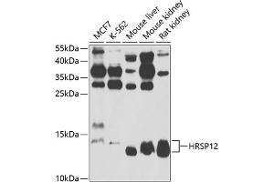 Western blot analysis of extracts of various cell lines, using HRSP12 antibody  at 1:1000 dilution. (HRSP12 抗体  (AA 1-137))