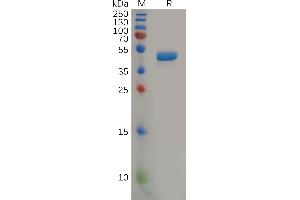 Human IL2 Protein, mFc Tag on SDS-PAGE under reducing condition. (IL-2 Protein (AA 21-153) (mFc Tag))