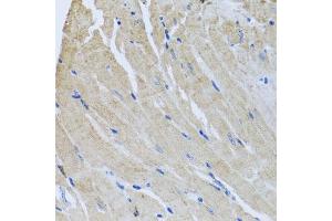 Immunohistochemistry of paraffin-embedded mouse heart using SRI antibody  at dilution of 1:100 (40x lens). (SRI 抗体  (AA 1-198))