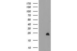 HEK293T cells were transfected with the pCMV6-ENTRY control (Left lane) or pCMV6-ENTRY MMAB (Right lane) cDNA for 48 hrs and lysed. (MMAB 抗体)