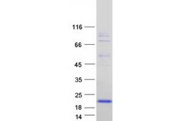 FXYD6 Protein (Transcript Variant 3) (Myc-DYKDDDDK Tag)