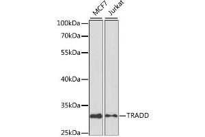Western blot analysis of extracts of various cell lines, using TRADD antibody. (TRADD 抗体)