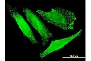 Immunofluorescence of monoclonal antibody to SLC25A20 on HeLa cell. (SLC25A20 抗体  (AA 1-301))