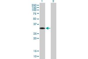 Western Blot analysis of ZBTB32 expression in transfected 293T cell line by ZBTB32 MaxPab polyclonal antibody. (ZBTB32 抗体  (AA 1-302))