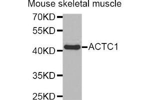 Western blot analysis of extracts of mouse skeletal muscle, using ACTC1 antibody (ABIN5973895). (ACTC1 抗体)