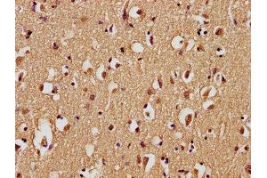 IHC image of ABIN7139743 diluted at 1:100 and staining in paraffin-embedded human brain tissue performed on a Leica BondTM system. (GPR77 抗体  (AA 2-19))