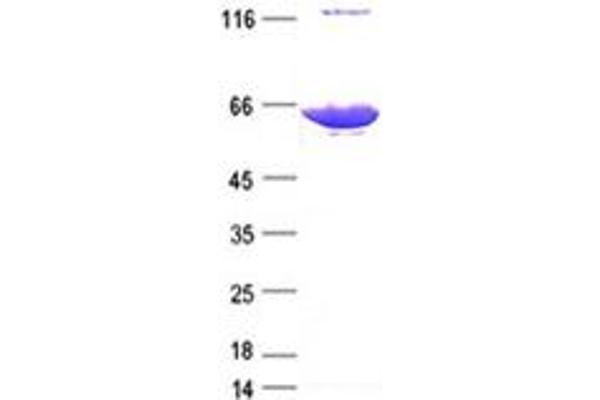 LRRC6 Protein (DYKDDDDK Tag)