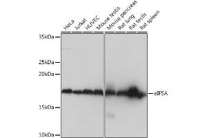 Western blot analysis of extracts of various cell lines, using eIF5A Rabbit mAb (ABIN1682900, ABIN7101685, ABIN7101686 and ABIN7101687) at 1:1000 dilution. (EIF5A 抗体)