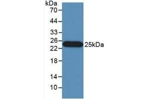 Detection of Recombinant IFNb, Human using Monoclonal Antibody to Interferon Beta (IFNb) (IFNB1 抗体)