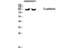 Western blot analysis of customer's using E-cadherin Polyclonal Antibody diluted at 1:1000. (E-cadherin 抗体  (AA 1-80))