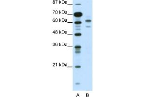 WB Suggested Anti-ZSCAN2 Antibody Titration:  0. (ZSCAN2 抗体  (N-Term))