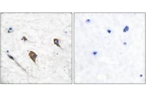 Immunohistochemistry analysis of paraffin-embedded human brain, using IL-3R beta (Phospho-Tyr593) Antibody. (CSF2RB2 抗体  (pTyr593))