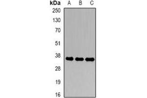 Western blot analysis of CDK6 expression in SW620 (A), Hela (B), Jurkat (C) whole cell lysates. (CDK6 抗体)