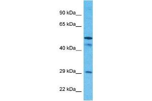 Host:  Rabbit  Target Name:  SCMC1  Sample Type:  MCF7 Whole Cell lysates  Antibody Dilution:  1. (SLC25A24 抗体  (N-Term))