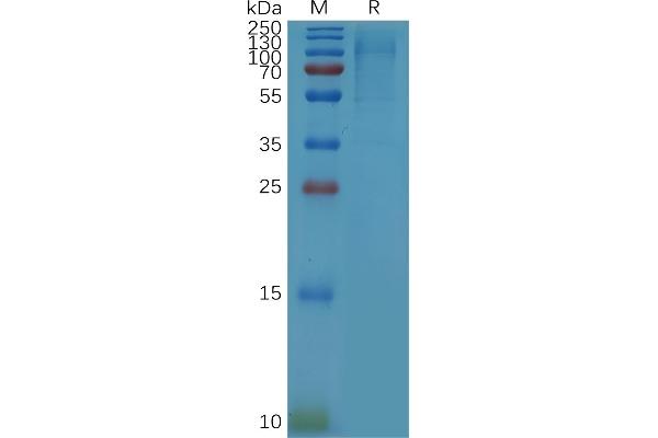 ARHGEF5 Protein (AA 21-295) (His tag)