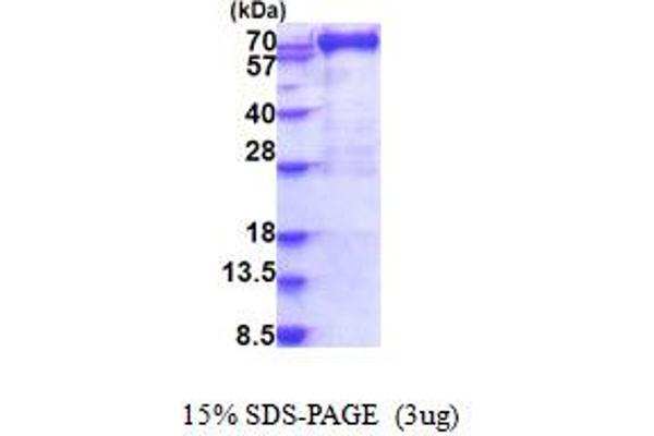 MX1 Protein (AA 1-662) (His tag)