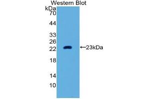 Detection of Recombinant MMP3, Human using Polyclonal Antibody to Matrix Metalloproteinase 3 (MMP3) (MMP3 抗体  (AA 289-452))